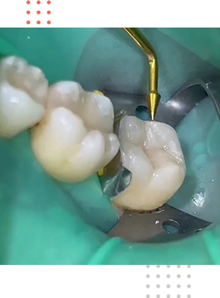 Restauracao estetica e funcional